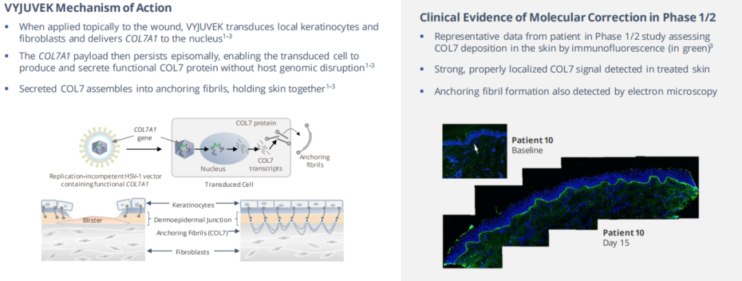 拯救“蝴蝶宝贝”！全球首款基因疗法来自一对“医药夫妻”